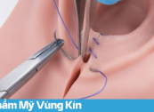 Có Nên Thẩm Mỹ Vùng Kín? Những Điều Chị Em Cần Cân Nhắc