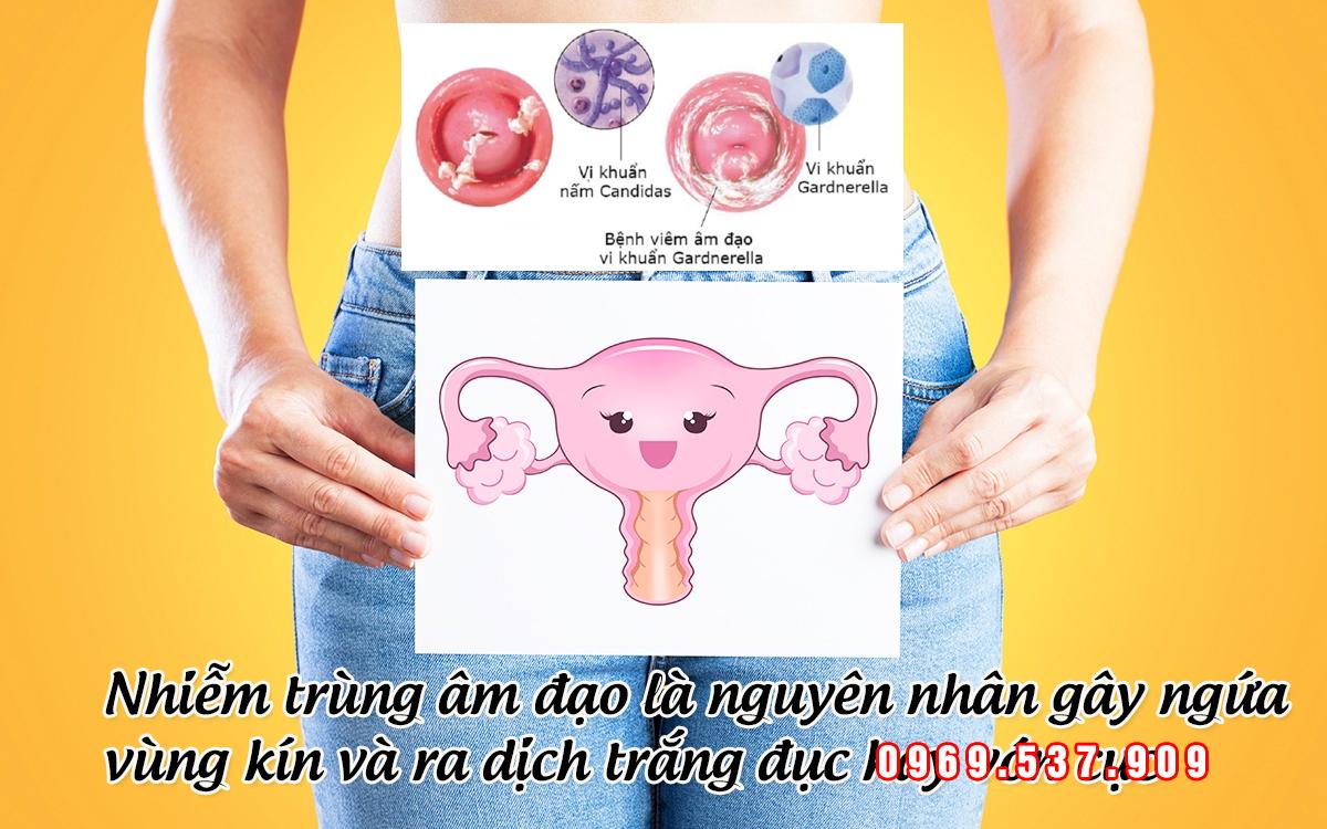 nhiễm trùng âm đạo