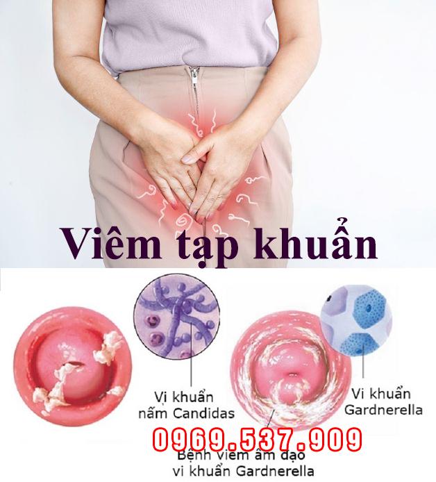 viêm tạp khuẩn