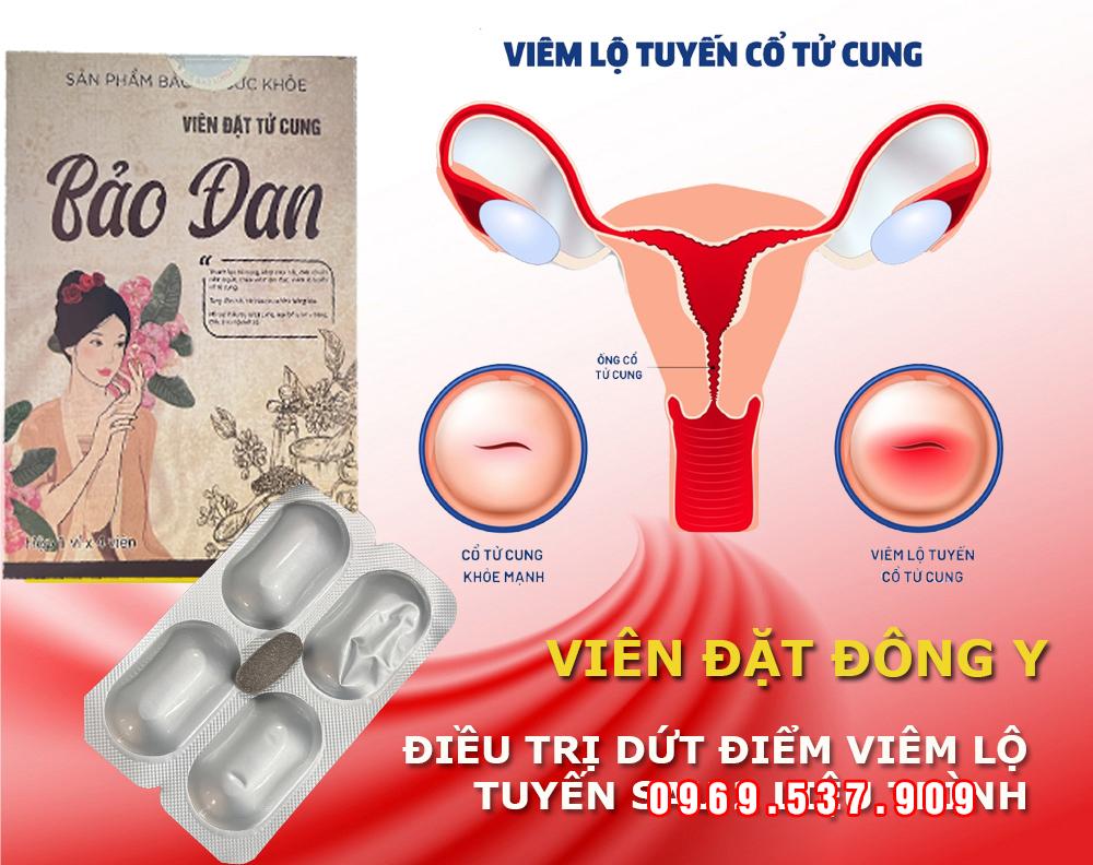 viêm lộ tuyến ctc