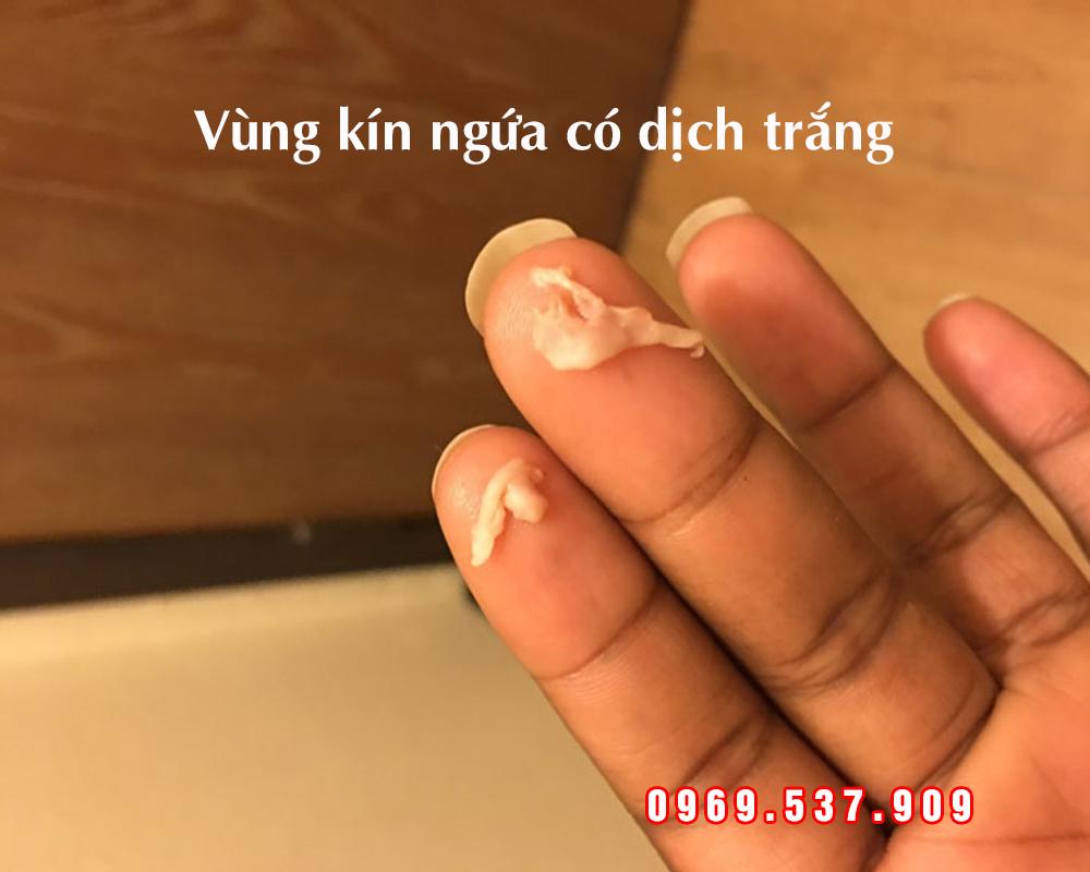 vùng kín ngứa có dịch trắng